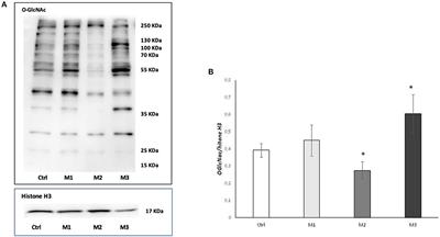 Effects of Vitamin E-Stabilized Ultra High Molecular Weight Polyethylene on Oxidative Stress Response and Osteoimmunological Response in Human Osteoblast